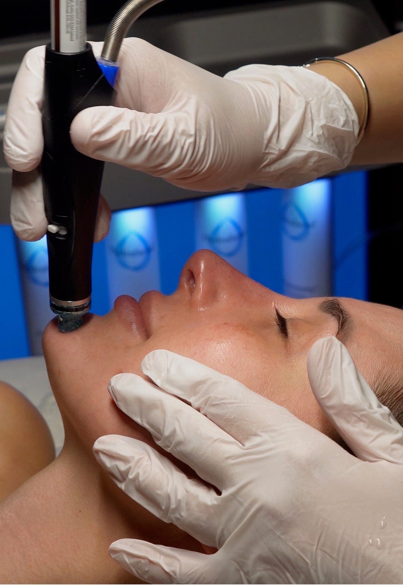 HydraFacial treatment in progress at Skin Study Med Spa in Plano, TX