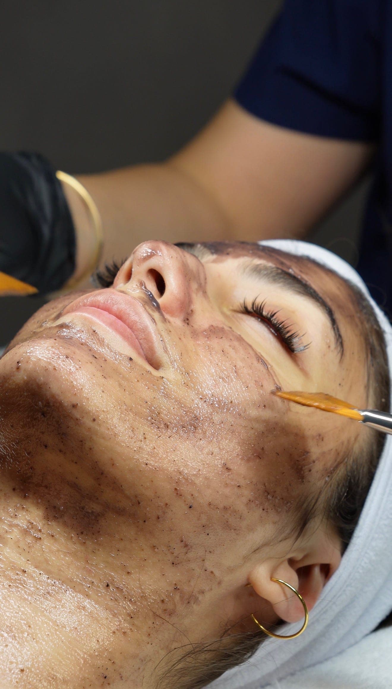 Professional chemical peel application at Skin Study Med Spa in Plano, TX